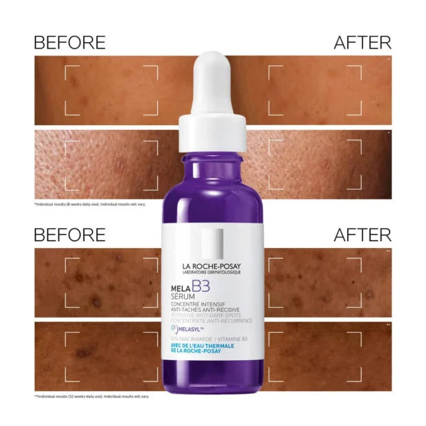 La Roche Posay Mela B3 Sérum 30ml