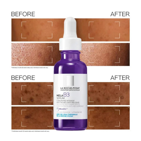 La Roche Posay Mela B3 Sérum 30ml